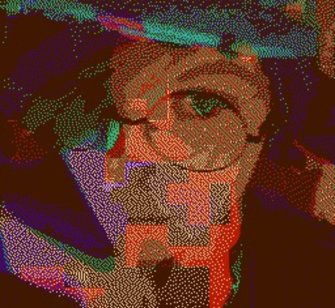 anxurysm